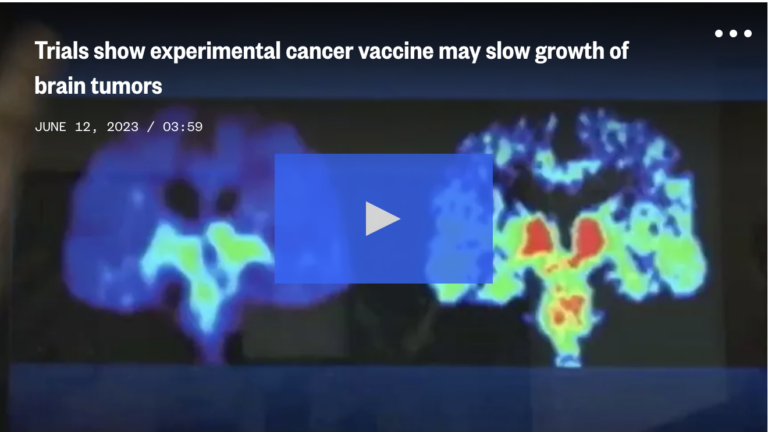 Screen Shot 2023-06-15 at 11.48.50 AM Video brain scan