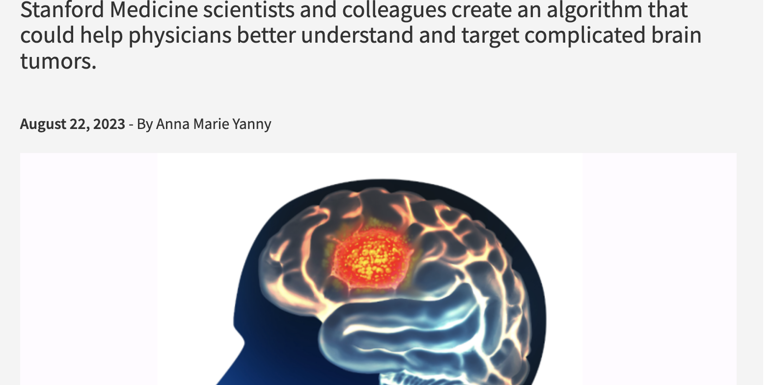 Screen Shot 2023-10-18 at 8.24.38 PM Article about Standford researchers using Artificial Intelligence for glioblastoma